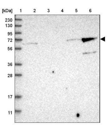 Western Blot: KLHL26 Antibody [NBP2-34187] - Lane 1: Marker  [kDa] 230, 130, 95, 72, 56, 36, 28, 17, 11.  Lane 2: Human cell line RT-4.  Lane 3: Human cell line U-251MG sp.  Lane 4: Human plasma (IgG/HSA depleted).  Lane 5: Human liver tissue.  Lane 6: Human tonsil tissue