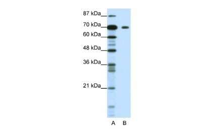 Western Blot: KLHL26 Antibody [NBP2-83116] - WB Suggested Anti-KLHL26 Antibody Titration: 1.25ug/ml. ELISA Titer: 1:1562500. Positive Control: Jurkat cell lysateKLHL26 is supported by BioGPS gene expression data to be expressed in Jurkat