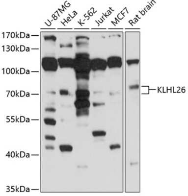Western Blot: KLHL26 Antibody [NBP3-04994] - Analysis of extracts of various cell lines, using KLHL26 antibody at 1:1000 dilution. Secondary antibody: HRP Goat Anti-Rabbit IgG (H+L) at 1:10000 dilution. Lysates/proteins: 25ug per lane. Blocking buffer: 3% nonfat dry milk in TBST. Detection: ECL Basic Kit