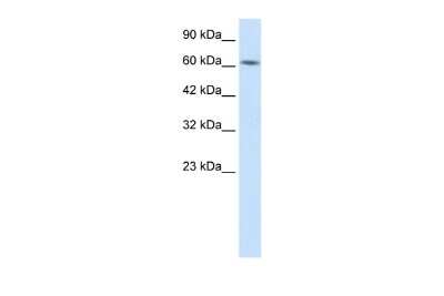 Western Blot: KLHL28 Antibody [NBP2-85161] - WB Suggested Anti-BTBD5 Antibody Titration: 1.0ug/ml. ELISA Titer: 1:1562500. Positive Control: HepG2 cell lysate