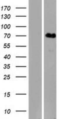 Western Blot: KLHL31 Overexpression Lysate (Adult Normal) [NBP2-08920] Left-Empty vector transfected control cell lysate (HEK293 cell lysate); Right -Over-expression Lysate for KLHL31.