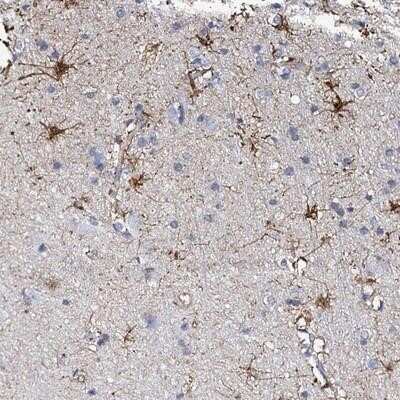 <b>Orthogonal Strategies Validation. </b>Immunohistochemistry-Paraffin: KLHL32 Antibody [NBP2-14169] - Staining of human cerebral cortex shows strong cytoplasmic positivity in glial cells.