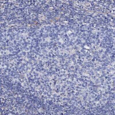 Immunohistochemistry-Paraffin: KLHL32 Antibody [NBP2-14169] - Staining of human tonsil shows low expression as expected.