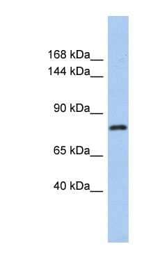 Western Blot: KLHL32 Antibody [NBP1-56298] - OVCAR-3 cell lysate, concentration 0.2-1 ug/ml.