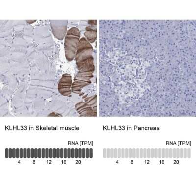 Immunocytochemistry/Immunofluorescence: KLHL33 Antibody [NBP3-17104] - Analysis in human skeletal muscle and pancreas tissues using Anti-KLHL33 antibody. Corresponding KLHL33 RNA-seq data are presented for the same tissues.