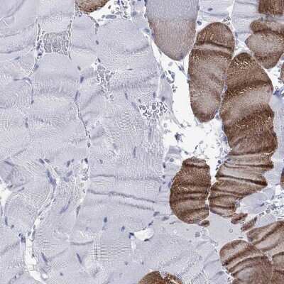 Immunohistochemistry-Paraffin: KLHL33 Antibody [NBP3-17104] - Staining of human skeletal muscle shows high expression.
