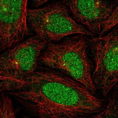Immunocytochemistry/ Immunofluorescence KLHL35 Antibody - BSA Free