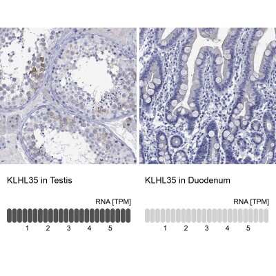 Immunocytochemistry/ Immunofluorescence KLHL35 Antibody - BSA Free