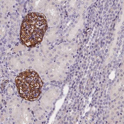 Immunohistochemistry-Paraffin: KLHL35 Antibody [NBP1-89837] - Staining of human kidney shows strong membranous positivity in glomeruli.