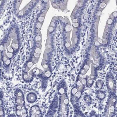 Immunohistochemistry-Paraffin: KLHL35 Antibody [NBP3-17105] - Staining of human duodenum shows low expression as expected.