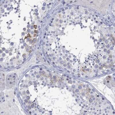 Immunohistochemistry-Paraffin: KLHL35 Antibody [NBP3-17105] - Staining of human testis shows high expression.