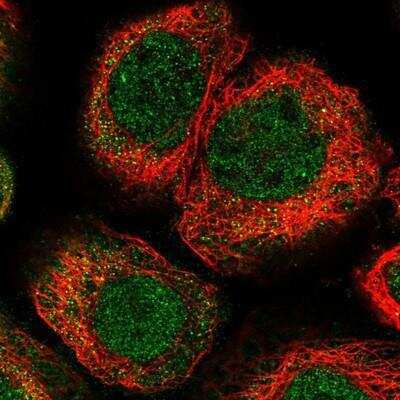 Immunocytochemistry/Immunofluorescence: KLHL7 Antibody [NBP1-81349] - Staining of human cell line A-431 shows positivity in nucleus but not nucleoli and cytoplasm.