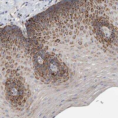 Immunohistochemistry-Paraffin: KLHL7 Antibody [NBP1-81349] - Staining of human esophagus shows strong granular positivity in squamous epithelial cells.