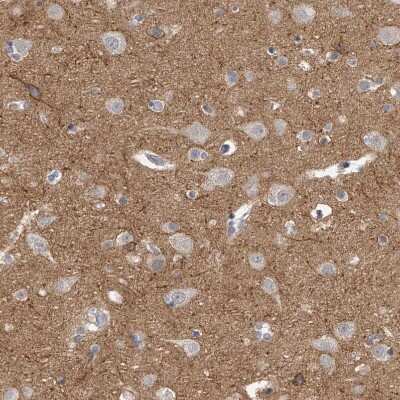 Immunohistochemistry-Paraffin KLHL7 Antibody - BSA Free