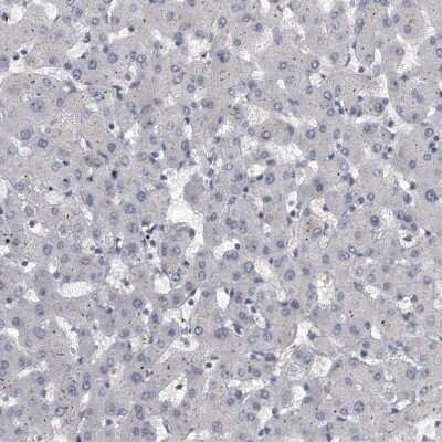 Immunohistochemistry-Paraffin: KLHL7 Antibody [NBP1-82871] - Staining of human liver shows no positivity in hepatocytes as expected.