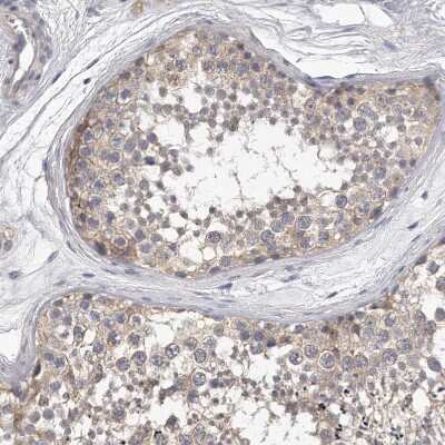 Immunohistochemistry-Paraffin KLHL7 Antibody - BSA Free