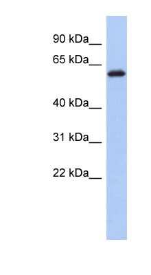 Western Blot: KLHL7 Antibody [NBP1-55462] - Human Brain lysate, concentration 0.2-1 ug/ml.