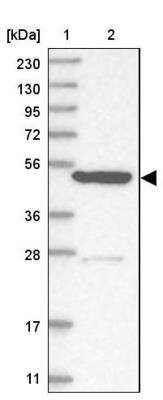 Western Blot: KLHL7 Antibody [NBP1-82871] - Lane 1: Marker  [kDa] 230, 130, 95, 72, 56, 36, 28, 17, 11.  Lane 2: Human cell line RT-302
