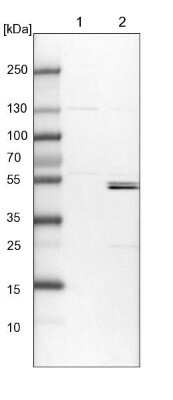 Western Blot: KLHL7 Antibody [NBP1-82871] - Lane 1: NIH-3T3 cell lysate (Mouse embryonic fibroblast cells). Lane 2: NBT-II cell lysate (Rat Wistar bladder tumor cells).