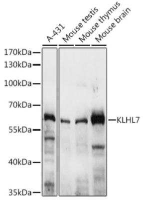 Western Blot: KLHL7 Antibody [NBP3-03938] - Western blot analysis of extracts of various cell lines, using KLHL7 antibody at 1:3000 dilution. Secondary antibody: HRP Goat Anti-Rabbit IgG (H+L) at 1:10000 dilution. Lysates/proteins: 25ug per lane. Blocking buffer: 3% nonfat dry milk in TBST. Detection: ECL Basic Kit. Exposure time: 10s.