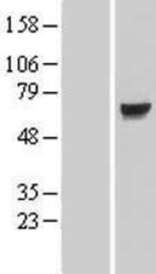 Western Blot: KLHL7 Overexpression Lysate (Adult Normal) [NBL1-12342] Left-Empty vector transfected control cell lysate (HEK293 cell lysate); Right -Over-expression Lysate for KLHL7.