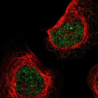 Immunocytochemistry/Immunofluorescence: KLHL8 Antibody [NBP2-47406] - Immunofluorescent staining of human cell line A-431 shows localization to nucleoplasm.