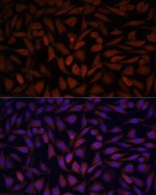 Immunocytochemistry/Immunofluorescence: KLHL8 Antibody [NBP3-04914] - Analysis of L929 cells using KLHL8 antibody at dilution of 1:100. Blue: DAPI for nuclear staining.