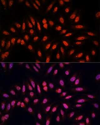 Immunocytochemistry/Immunofluorescence: KLHL8 Antibody [NBP3-04914] - Analysis of U-2 OS cells using KLHL8 antibody at dilution of 1:100. Blue: DAPI for nuclear staining.