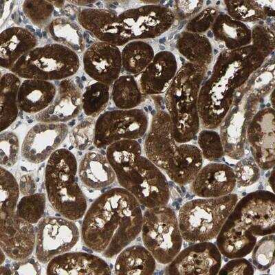 Immunohistochemistry-Paraffin: KLHL8 Antibody [NBP1-81415] - Staining of human kidney shows strong nuclear and cytoplasmic positivity in cells in tubules.