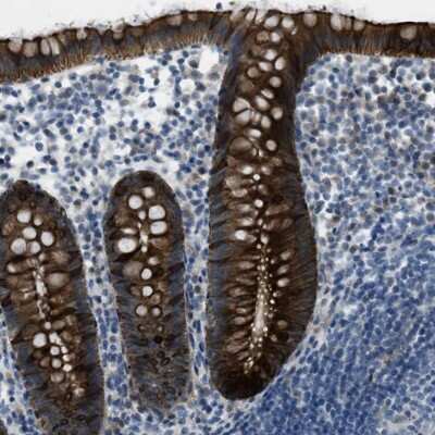 Immunohistochemistry-Paraffin: KLHL8 Antibody [NBP2-47406] - Staining of human appendix shows strong cytoplasmic positivity in glandular cells.