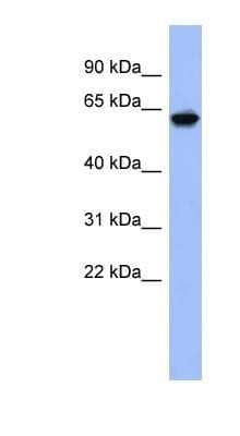 Western Blot: KLHL8 Antibody [NBP1-80346] - Human Thymus lysate, concentration 0.2-1 ug/ml.