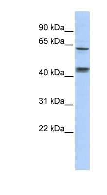 Western Blot: KLHL8 Antibody [NBP1-80347] - Titration: 0.2-1 ug/ml, Positive Control: 721_B cell lysate.