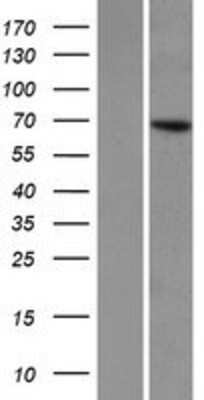 Western Blot: KLHL8 Overexpression Lysate (Adult Normal) [NBP2-06587] Left-Empty vector transfected control cell lysate (HEK293 cell lysate); Right -Over-expression Lysate for KLHL8.