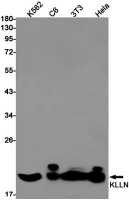 Western Blot: KLLN Antibody (S08-5C6) [NBP3-14970] - Western blot detection of KLLN in K562, C6, 3T3, Hela cell lysates using KLLN Rabbit mAb (1:1000 diluted). Predicted band size: 20kDa. Observed band size: 20kDa.