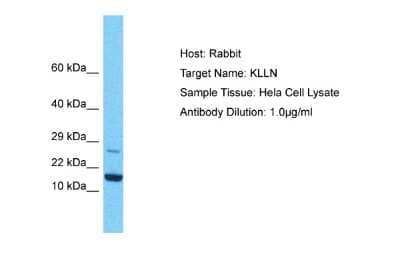 Western Blot: KLLN Antibody [NBP2-83124] - Host: Rabbit. Target Name: KLLN. Sample Type: Hela Whole Cell lysates. Antibody Dilution: 1.0ug/ml