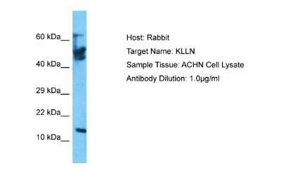 Western Blot: KLLN Antibody [NBP2-83125] - Host: Rabbit. Target Name: KLLN. Sample Tissue: Human ACHN Whole Cell. Antibody Dilution: 1ug/ml