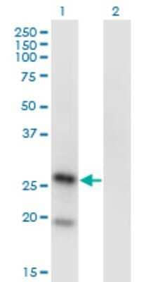 Western Blot KLRA1 Antibody (1H3)