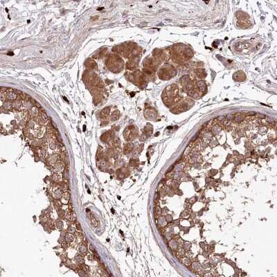 Immunohistochemistry KLRAQ1 Antibody - BSA Free