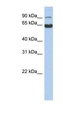 Western Blot: KLRAQ1 Antibody [NBP1-56287] - Human Muscle lysate, concentration 0.2-1 ug/ml.