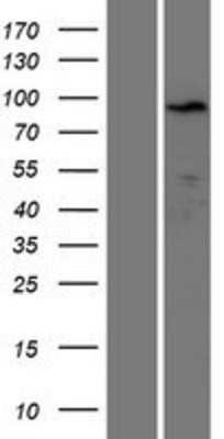 Western Blot: KLRAQ1 Overexpression Lysate (Adult Normal) [NBP2-05299] Left-Empty vector transfected control cell lysate (HEK293 cell lysate); Right -Over-expression Lysate for KLRAQ1.