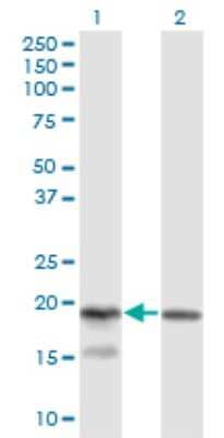 Western Blot: KLRC4 Antibody (1D10) [H00008302-M03] - Analysis of KLRC4 expression in transfected 293T cell line by KLRC4 monoclonal antibody (M03), clone 1D10. Lane 1: KLRC4 transfected lysatE (18.2 KDa). Lane 2: Non-transfected lysate.