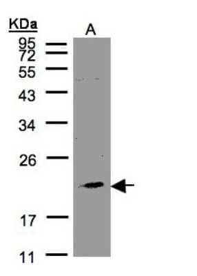 Western Blot: KLRC4 Antibody [NBP1-31161] - Sample(30 ug of whole cell lysate)A:293T12% SDS PAGE, antibody diluted at 1:1000.