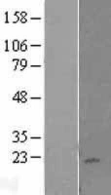 Western Blot: KLRC4 Overexpression Lysate (Adult Normal) [NBL1-12364] Left-Empty vector transfected control cell lysate (HEK293 cell lysate); Right -Over-expression Lysate for KLRC4.