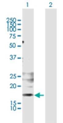 Western Blot: KLRG1 Antibody [H00010219-B01P] - Analysis of KLRG1 expression in transfected 293T cell line by KLRG1 polyclonal antibody.  Lane 1: KLRG1 transfected lysate(20.79 KDa). Lane 2: Non-transfected lysate.