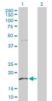 Western Blot: KLRG1 Antibody [H00010219-D01P] - Analysis of KLRG1 expression in transfected 293T cell line by KLRG1 polyclonal antibody.Lane 1: KLRG1 transfected lysate(21.20 KDa).Lane 2: Non-transfected lysate.