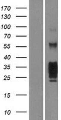 Western Blot: KLRG1 Overexpression Lysate (Adult Normal) [NBP2-07698] Left-Empty vector transfected control cell lysate (HEK293 cell lysate); Right -Over-expression Lysate for KLRG1.