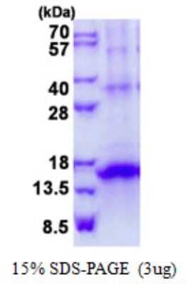 SDS-Page: Recombinant Human KLRG1 Protein [NBP2-23172]