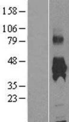 Western Blot: KMO Overexpression Lysate (Adult Normal) [NBP2-04254] Left-Empty vector transfected control cell lysate (HEK293 cell lysate); Right -Over-expression Lysate for KMO.