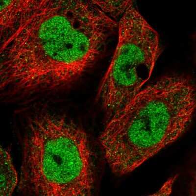 Immunocytochemistry/Immunofluorescence: KMT2A/MLL Antibody [NBP2-55237] - Staining of human cell line A-431 shows localization to nucleoplasm.