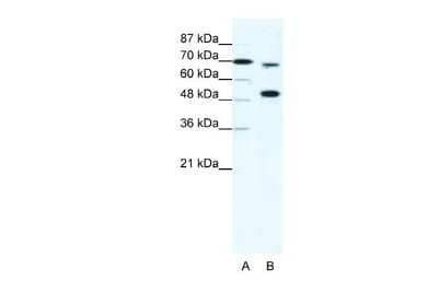 Western Blot: KMT2B Antibody [NBP2-82270] - WB Suggested Anti-MLL4 Antibody Titration: 5ug/ml. Positive Control: HepG2 cell lysateKMT2B is strongly supported by BioGPS gene expression data to be expressed in Human HepG2 cells